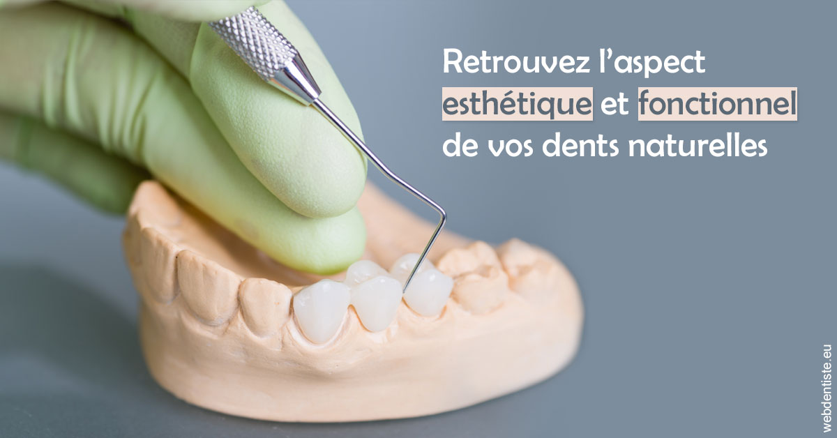 https://www.drgoddefroy.fr/Restaurations dentaires 1