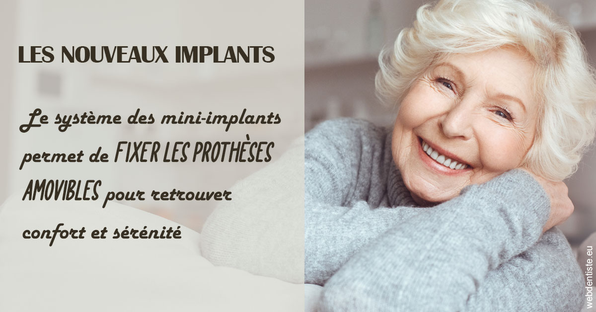 https://www.drgoddefroy.fr/Les nouveaux implants 1