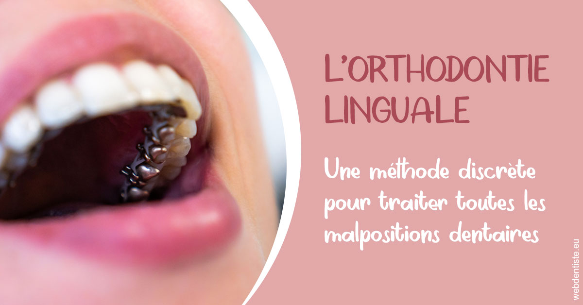 https://www.drgoddefroy.fr/L'orthodontie linguale 2