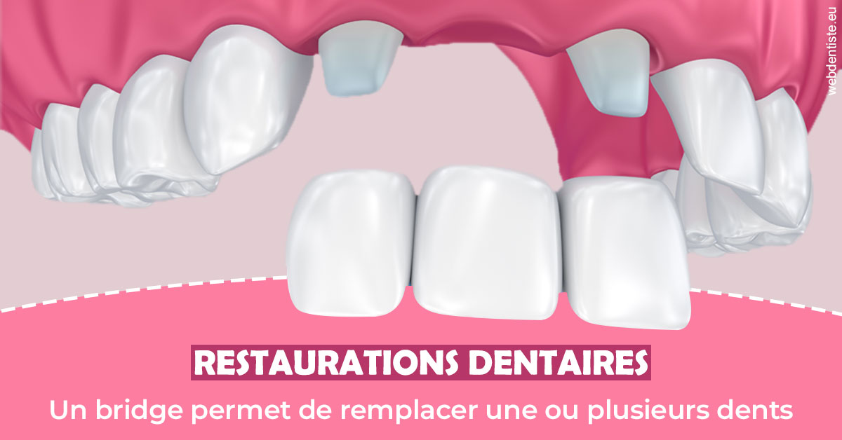 https://www.drgoddefroy.fr/Bridge remplacer dents 2