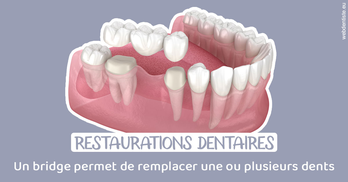 https://www.drgoddefroy.fr/Bridge remplacer dents 1
