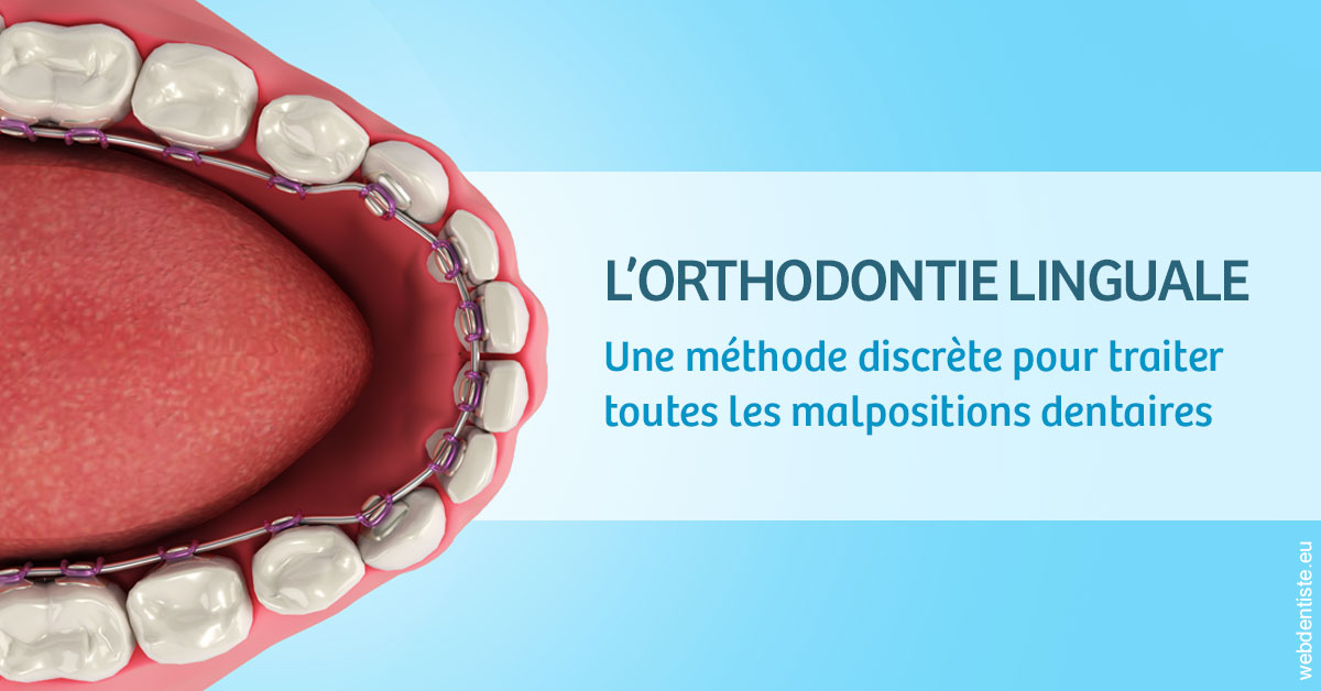 https://www.drgoddefroy.fr/L'orthodontie linguale 1