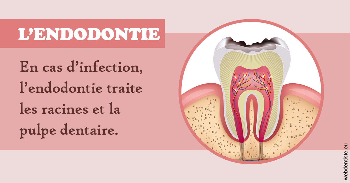 https://www.drgoddefroy.fr/L'endodontie 2