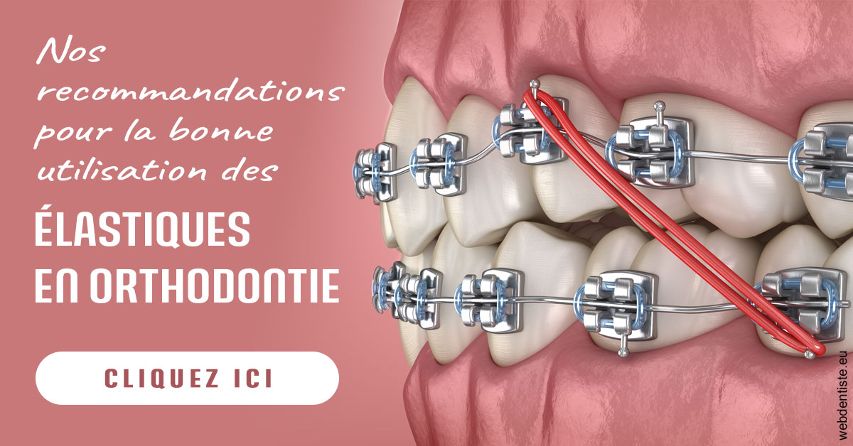 https://www.drgoddefroy.fr/Elastiques orthodontie 2